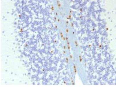 Immunohistochemistry-Paraffin: SOX10 Antibody (SOX10/1074) [NBP2-59622]