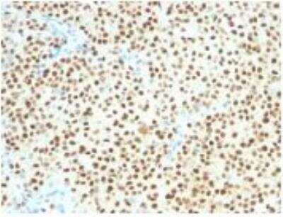 Immunohistochemistry-Paraffin: SOX10 Antibody (SOX10/1074) [NBP2-59622]