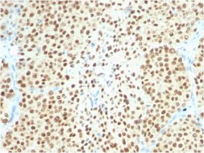 Immunohistochemistry-Paraffin: SOX10 Antibody (SOX10/2311R) [NBP2-79770]