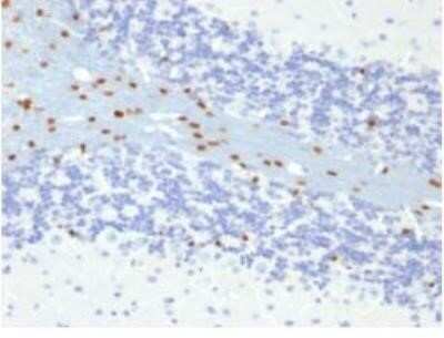 Immunohistochemistry-Paraffin: SOX10 Antibody (SOX10/991) - Azide and BSA Free [NBP2-59621]