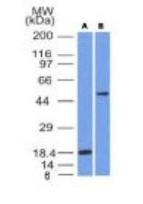 Western Blot: SOX10 Antibody (SOX10/991)Azide and BSA Free [NBP2-59621]