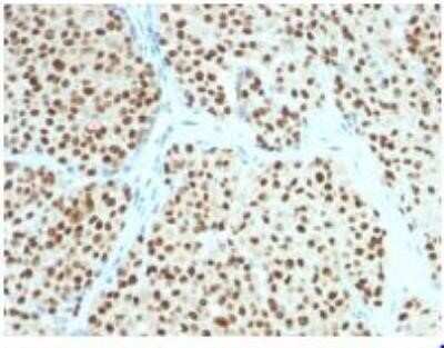 Immunohistochemistry-Paraffin: SOX10 Antibody (SOX10/991) - IHC-Prediluted [NBP2-48436]