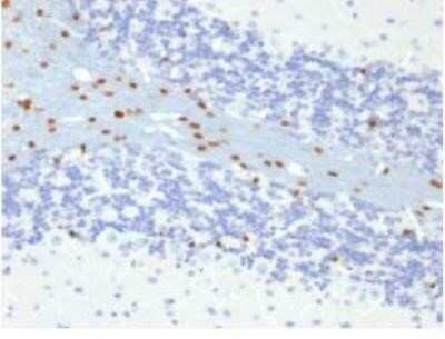 Immunohistochemistry-Paraffin: SOX10 Antibody (SOX10/991) - IHC-Prediluted [NBP2-48436]