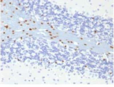 Immunohistochemistry-Paraffin: SOX10 Antibody (SOX10/991) [NBP2-59620]