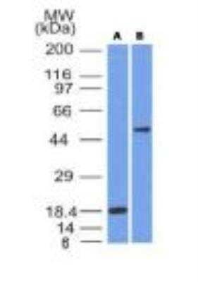 Western Blot: SOX10 Antibody (SOX10/991) [NBP2-59620]