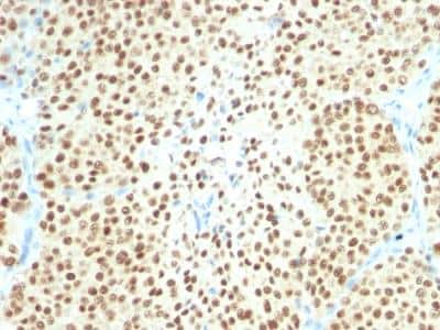 Immunohistochemistry-Paraffin: SOX10 Antibody (SPM607) - IHC-Prediluted [NBP2-48444]