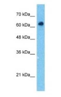 Western Blot: SOX10 Antibody [NBP1-68983]