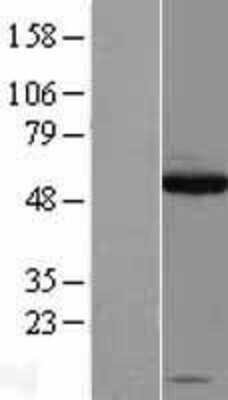 Western Blot: SOX10 Overexpression Lysate [NBL1-16344]