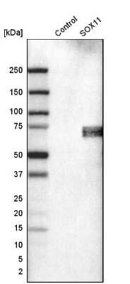 Western Blot: SOX11 Antibody (CL0142) [NBP2-14782]