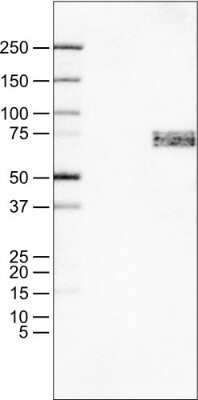 Western Blot: SOX11 Antibody (CL0143) [NBP2-52865]