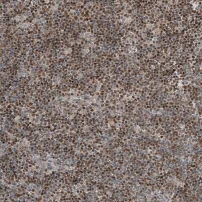 Immunohistochemistry-Paraffin: SOX11 Antibody [NBP1-85823]