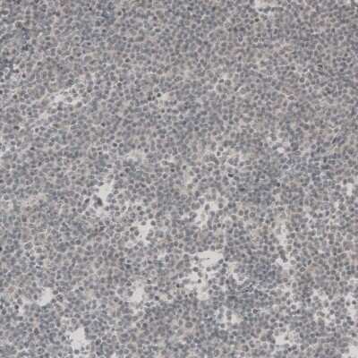 Immunohistochemistry-Paraffin: SOX11 Antibody [NBP1-85823]