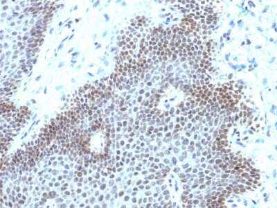 Immunohistochemistry-Paraffin: SOX11 Antibody (SOX11/3235R) - Azide and BSA Free [NBP3-08594]