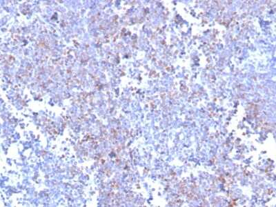 Immunohistochemistry-Paraffin: SOX11 Antibody (SOX11/3235R) - Azide and BSA Free [NBP3-08594]