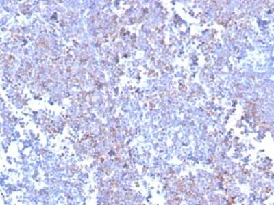 Immunohistochemistry-Paraffin: SOX11 Antibody (SOX11/3235R) [NBP3-07688]