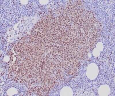 Immunohistochemistry-Paraffin: SOX11 Antibody (SOX11/7236) [NBP3-13779]