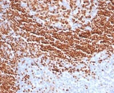 Immunohistochemistry-Paraffin: SOX11 Antibody (SOX11/7236) [NBP3-13779]