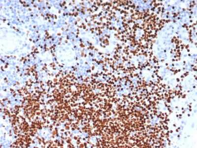 Immunohistochemistry-Paraffin: SOX11 Antibody (SOX11/7236) [NBP3-13779]