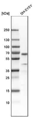 Western Blot: SOX11 Antibody [NBP1-85823]