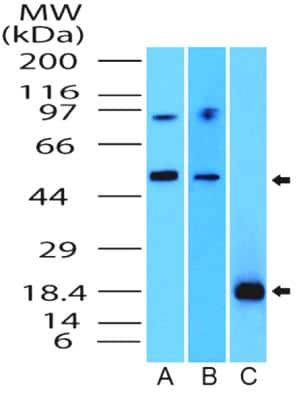 Western Blot: SOX11 Antibody [NBP2-31371]