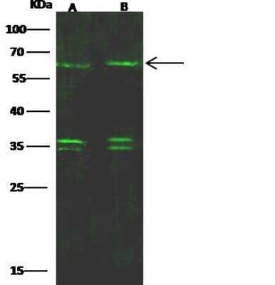 Western Blot: SOX11 Antibody [NBP2-98872]