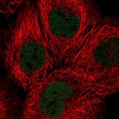 Immunocytochemistry/ Immunofluorescence: SOX13 Antibody [NBP2-54996]