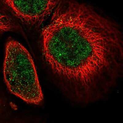 Immunocytochemistry/ Immunofluorescence: SOX13 Antibody [NBP2-58396]