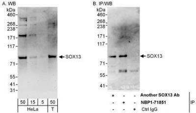 Western Blot: SOX13 Antibody [NBP1-71851]