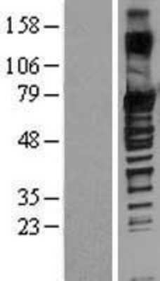 Western Blot: SOX13 Overexpression Lysate [NBL1-16346]