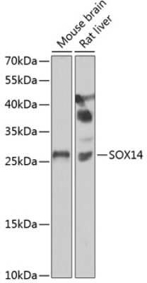 Western Blot: SOX14 AntibodyBSA Free [NBP2-93022]