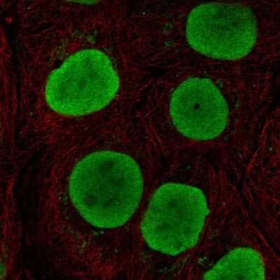 Immunocytochemistry/ Immunofluorescence: SOX15 Antibody [NBP2-56063]