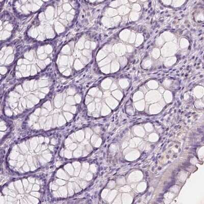 Immunohistochemistry-Paraffin: SOX15 Antibody [NBP2-38101]