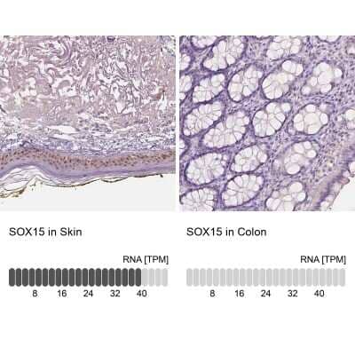 Immunohistochemistry-Paraffin: SOX15 Antibody [NBP2-38101]