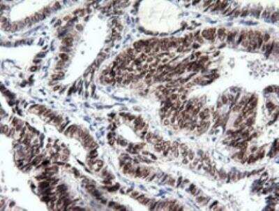 Immunohistochemistry-Paraffin: SOX17 Antibody (OTI2B6) [NBP1-47996]