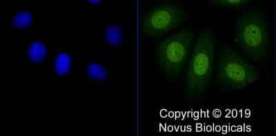 Immunocytochemistry/ Immunofluorescence: SOX17 Antibody - BSA Free [NBP2-24568]