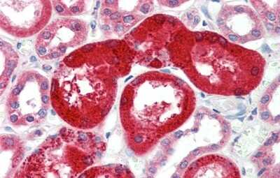 Immunohistochemistry-Paraffin: SOX17 Antibody [NBP1-80362]