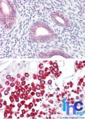 Immunohistochemistry-Paraffin: SOX17 Antibody - BSA Free [NBP2-24568]
