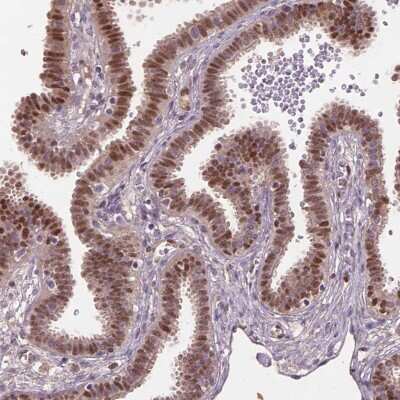Immunohistochemistry-Paraffin: SOX17 Antibody [NBP2-49549]