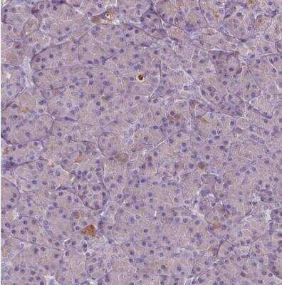 Immunohistochemistry-Paraffin: SOX17 Antibody [NBP2-49549]