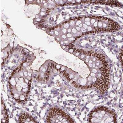 Immunohistochemistry-Paraffin: SOX17 Antibody [NBP2-49549]