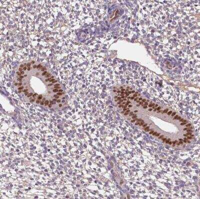 Immunohistochemistry-Paraffin: SOX17 Antibody [NBP2-49549]
