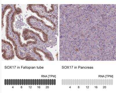 Immunohistochemistry-Paraffin: SOX17 Antibody [NBP2-49549]