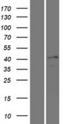 Western Blot: SOX17 Overexpression Lysate [NBL1-16347]