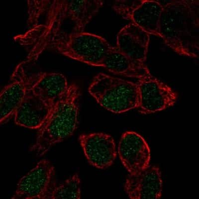 Immunocytochemistry/ Immunofluorescence: SOX18 Antibody [NBP2-58004]