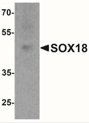 Western Blot: SOX18 AntibodyBSA Free [NBP2-41289]