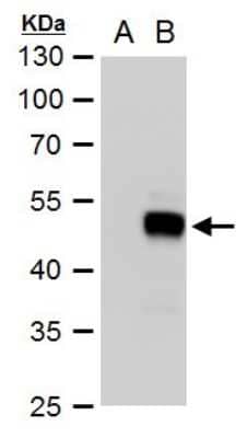 Western Blot: SOX18 Antibody [NBP2-43708]