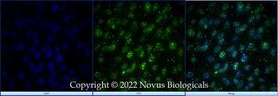 Immunocytochemistry/ Immunofluorescence: SOX2 Antibody - BSA Free [NB110-37235]
