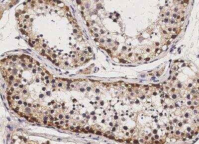 Immunohistochemistry-Paraffin: SOX2 Antibody (017) [NBP2-89196]