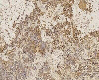 Immunohistochemistry: SOX2 Antibody (4G8) - Azide and BSA Free [NBP2-80957]