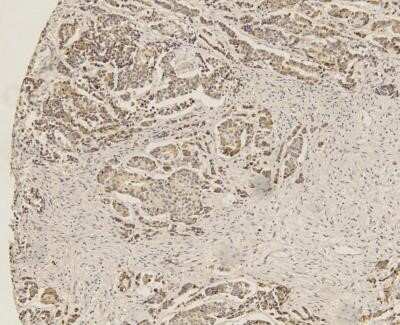 Immunohistochemistry: SOX2 Antibody (4G8) - Azide and BSA Free [NBP2-80957]